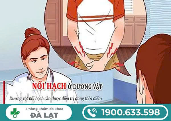 Hình ảnh minh họa